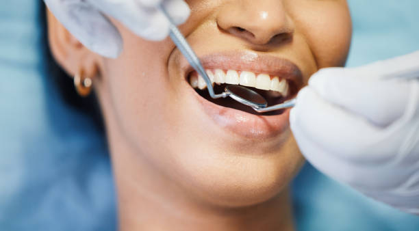 Best Emergency Root Canal Treatment in Hattiesburg, MS