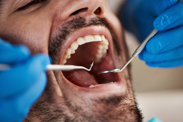 Best Emergency Dental Care for Broken or Chipped Teeth in Hattiesburg, MS